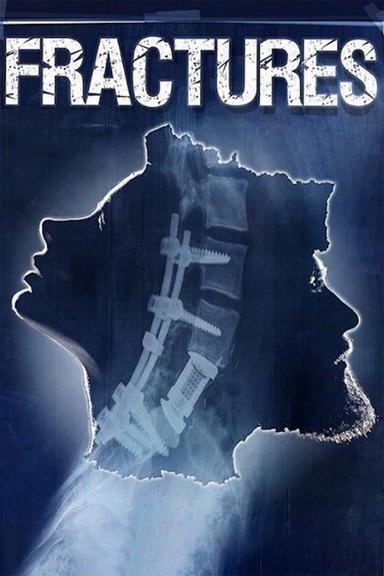 Fractures poster