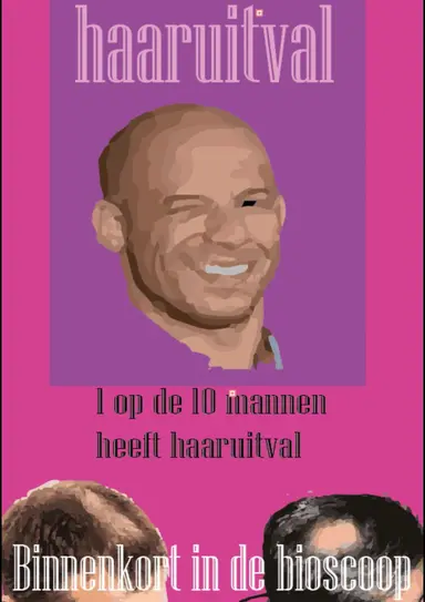 Kaal worden. Wat kan ik doen? poster